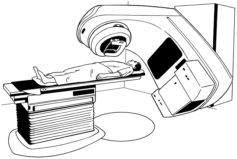 radiotherapy